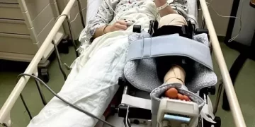 Zuckerberg, geçirdiği sakatlık sonrası ameliyat oldu