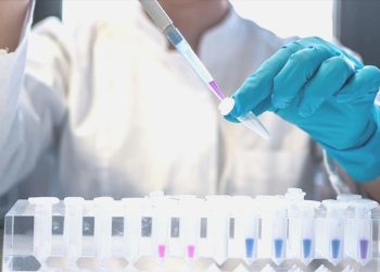 HIV erken teşhis ve tedaviyle “yönetilebilir” bir hastalık