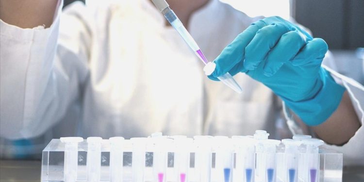 HIV erken teşhis ve tedaviyle “yönetilebilir” bir hastalık